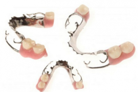 Протезирование зубов у детей: особенности, разновидности показания