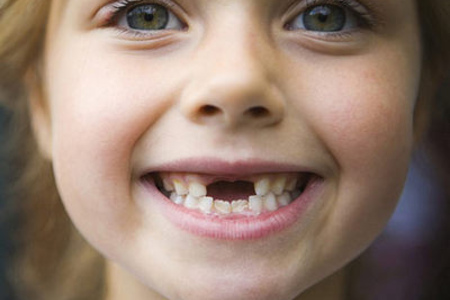Когда выпадают молочные зубы у детей? Что делать родителям?