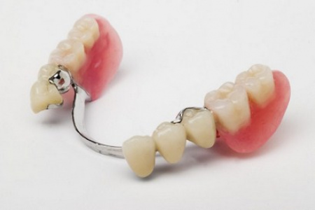Противопоказания к протезированию зубов