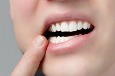 Этапы протезирования зубов металлокерамикой